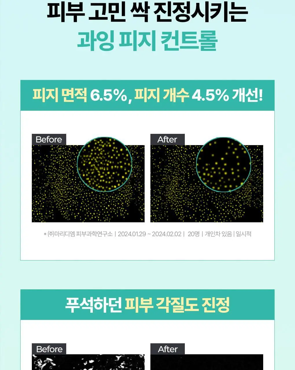 [온라인단독|진정SET] 브링그린 티트리 시카 수딩 토너&크림 세트 상세페이지 16